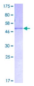 SDS-PAGE (FGA-4087H).jpg